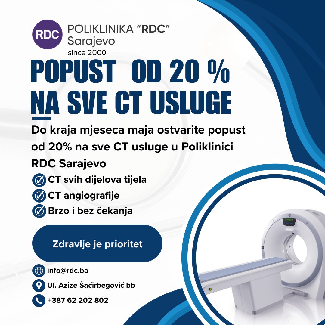 CT aparat