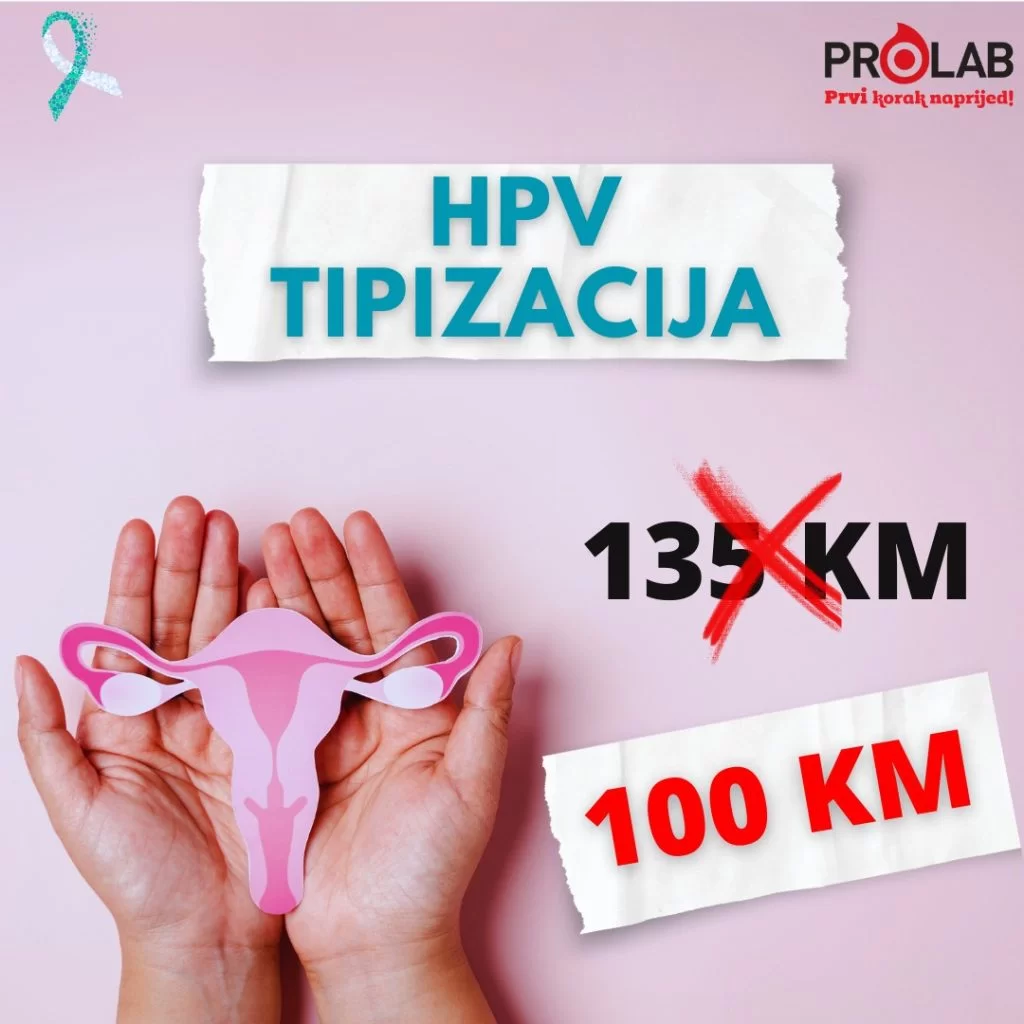 HPV TIPIZACIJA